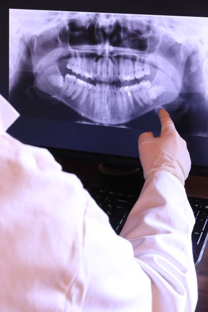 Best Emergency Treatment for Dental Infections or Abscesses in Punta Rassa, FL